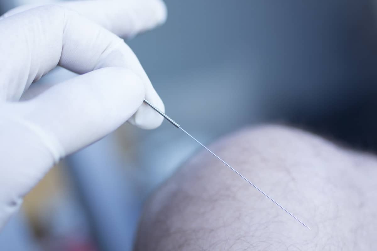 Cbt Needles