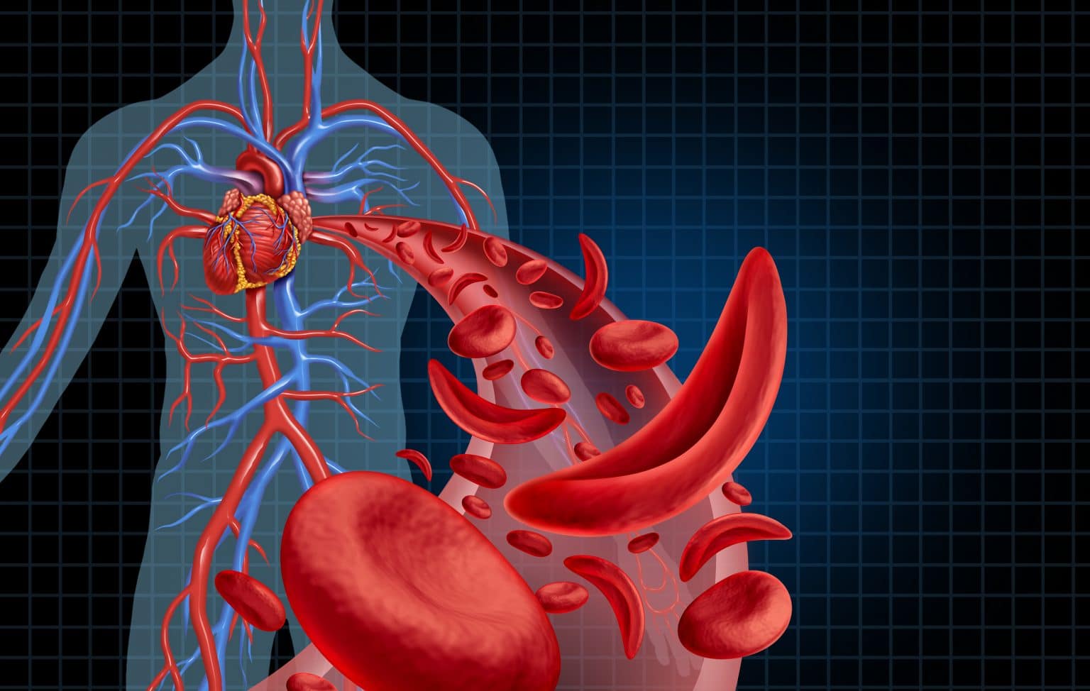 Sickle Cell Disease Cystic Fibrosis And Disparities In Federal Funding 0392